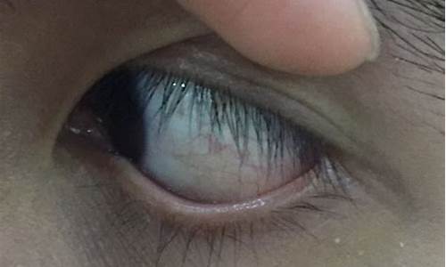 眼白一层膜一推有褶皱的原因(眼白一层膜一推有褶皱用什么眼药水)_https://www.023hushi.com_科创板_第1张